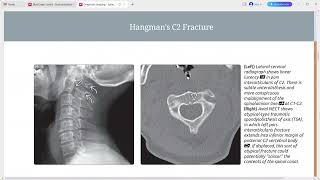 SPINE IMAGING DIAGNOSTIC IMAGING SERIES [upl. by Elagibba]