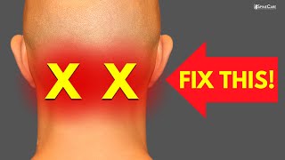 How to Instantly Relieve Neck Pain at the BASE OF THE SKULL [upl. by Young202]