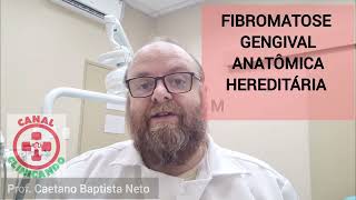 Cirurgia de remoção da Fibromatose Gengival Anatômica Idiopática Biópsia com bisturi elétrico [upl. by Ruberta]