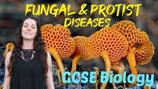 Fungal and protist diseases  GCSE Biology Revision for 2020 [upl. by Araik]