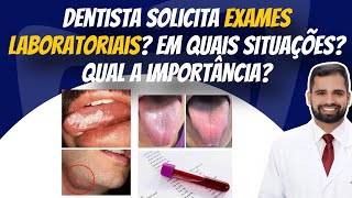 Exames laboratoriais Em quais situações o dentista deve solicitar Qual a importância exames [upl. by Eben]