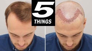 5 THINGS to do after HAIR TRANSPLANT [upl. by Aowda941]