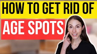 How To Get Rid Of Age Spots  Dermatologist Tips [upl. by Hughett]