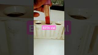 EDTA vial 💉💉 [upl. by Anihc681]