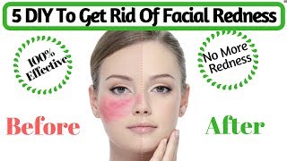 Natural Tips To Get Rid Of Facial Redness  How to Cure Red Irritated Skin  AVNI [upl. by Akcirederf]