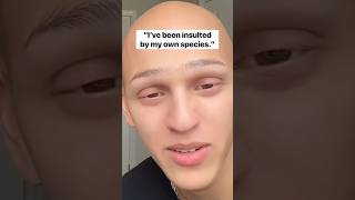 Chloe makes me NORMAL 😫 comedy funny lol alopecia [upl. by Edlitam]