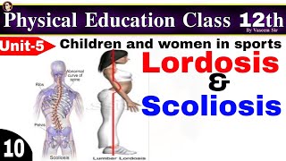 Lordosis and scoliosis  Physical education by Vaseem sir [upl. by Kcered]