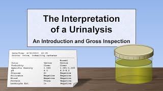 Interpretation of the Urinalysis Part 1  Introduction and Inspection [upl. by Theola734]