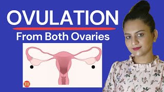 OVULATION From Both Ovaries दोनों ovary से Egg Release तो क्या PREGNANCY होती हैDrMrunaliniManoj [upl. by Ahseal]