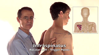 Trigger Point Release  Infraspinatus Muscle [upl. by Derinna]