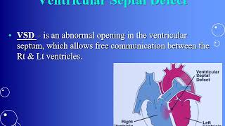 Acyanotic Congenital Heart Disease  cardiology  5th grade  Dr Mohamed AboelKassem [upl. by Orion]