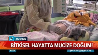 Bitkisel hayatta mucize doğum  Atv Haber 3 Eylül 2019 [upl. by Brenden358]