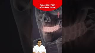 Top Reason For Pain After Root Canal Treatment Dental Insights by Dr Chirag Chamria  Royal Dental [upl. by Charleton160]