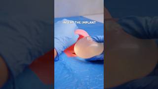 My surgeon learned from 5 minute crafts videos😥 [upl. by Will505]