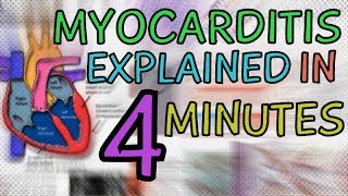 WHAT IS MYOCARDITIS MYOCARDITIS EXPLAINED IN 4 MINUTES  CAUSES SYMPTOMS DIAGNOSIS TREATMENT [upl. by Amsirak]