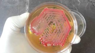 Hafnia alvei and Pink pigmented colony of S marcescens on MHA plat [upl. by Eerat668]