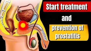 Effective Treatment and Prevention Tips for Prostatitis A Comprehensive Guidequot [upl. by Anirazc1]