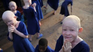 Albino People Hunted In Tanzania [upl. by Auston]