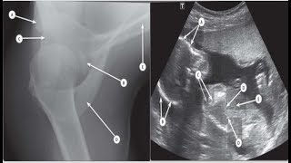 Exam2 pelvic anatomy with answers frcrradiologyMRICTXrayultrasoundHSGACUquestionsradio [upl. by Pieter]