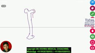 osteomyelitis pathology digital whiteboard sequestrum involucrum BY DRVISHWA MEDICAL 919930788955 [upl. by Waylon]