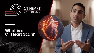 What Is A CT Heart Scan [upl. by Feerahs]