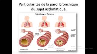 14Asthme Dr Djali BEO  Pneumo [upl. by Kendra307]