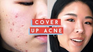 How to Cover Up Acne  My Secret to Concealing WHILE HEALING bumpy flaky skin [upl. by Imyaj253]