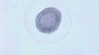 Amphioxus embryonic development [upl. by Myrtia]