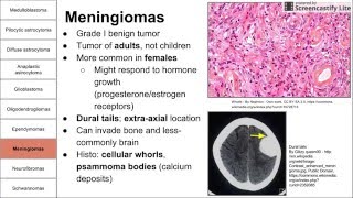 Nervous System Tumors [upl. by Pleione]