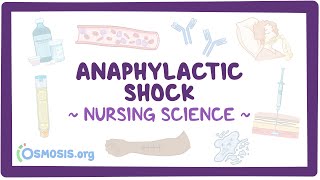 Anaphylactic shock Clinical Nursing Care [upl. by Gibbon766]