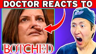 Plastic Surgeon Reacts to BOTCHED WTF Happened To Her NOSE [upl. by Lareine]