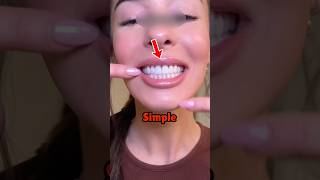 How To Get White Teeth 😨 [upl. by Esyla]