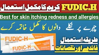 Fudic h cream use in urdu \ Fudic h cream benefits \for acne skinallergic [upl. by Server]