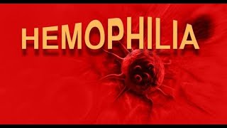 Understanding Hemophilia Causes Symptoms and Treatments [upl. by Aicia]