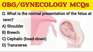 OBG GYNECOLOGY MCQs rrbnursingofficerexam aiimsnorcetmcq [upl. by Josepha]