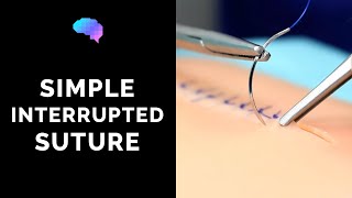 Simple interrupted suture wound suturing  OSCE Guide  UKMLA  CPSA [upl. by Tigdirb]