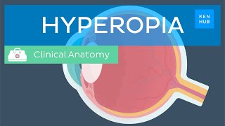 Farsightedness Hyperopia Definition causes symptoms diagnosis and treatment  Kenhub [upl. by Ynaffat]