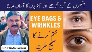 Treatment Of Dark Circles on Eyes Homoyobathic Dr Photo Sarwar [upl. by Godred]