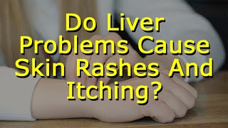 Do Liver Problems Cause Skin Rashes And Itching [upl. by Esertal]