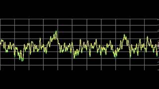 Candidiasis Candida Albicans  Rife Frequencies [upl. by Eiramyelhsa81]