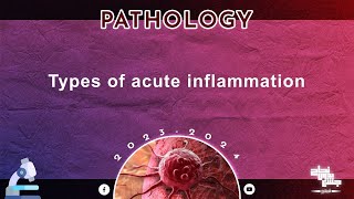 Extra of L7 Types of acute inflammation  Pathology [upl. by Wessling]