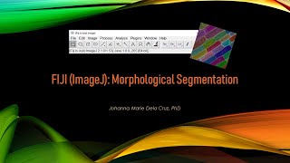 FIJI ImageJ Morphological Segmentation [upl. by Buffo843]