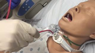 Tracheostomy suctioning [upl. by Lontson290]