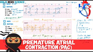 Rate and Rhythm  Premature Atrial Contraction PAC [upl. by Smart]