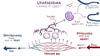 Lymphedema causes symptoms diagnosis treatment amp pathology [upl. by Oluas488]