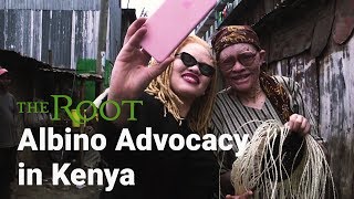 Kenyan Woman Beats Albinism [upl. by Amalie]