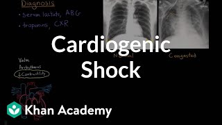 Cardiogenic shock  Circulatory System and Disease  NCLEXRN  Khan Academy [upl. by Dorene]