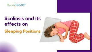 Scoliosis and its effects on sleeping positions sleepingpositions scolismart Scoliosis [upl. by Dorene]