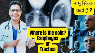 coin in chest Xray Trachea or Esophagus radiology ENTneet [upl. by Jakie]