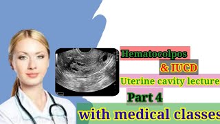 IUCD in Hindi uterine cavity cavity lecturepart 4  IUCD in ultrasound  Hematocolpos in Hindi [upl. by Ariajay]